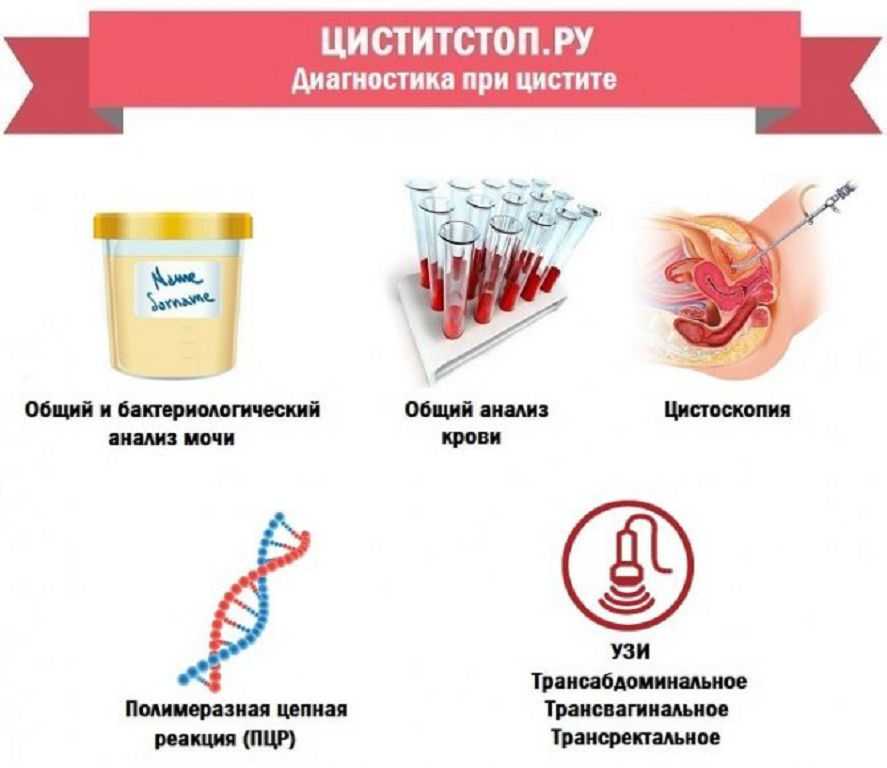 Самое правильное при расставании – уйти. цитаты и афоризмы про расставание