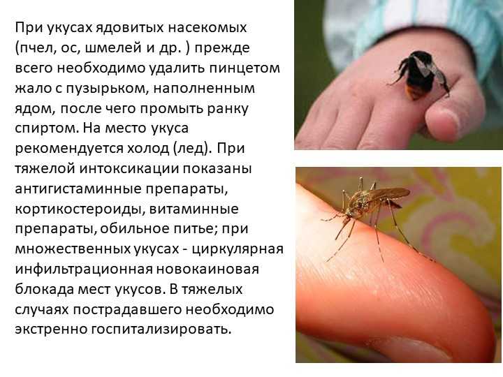 Укусы насекомых сообщение. При укусе насекомого необходимо.